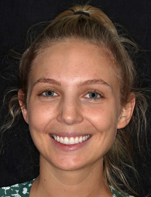 Patient Face Photo