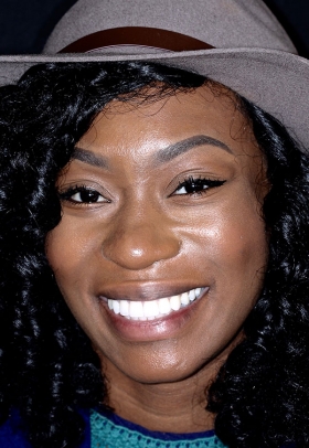 Porcelain Veneers After